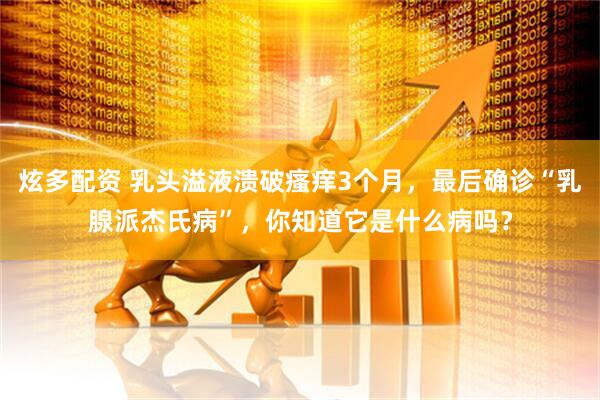 炫多配资 乳头溢液溃破瘙痒3个月，最后确诊“乳腺派杰氏病”，你知道它是什么病吗？